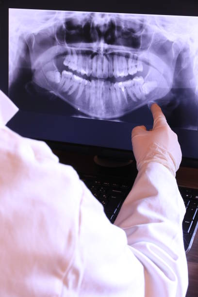 Best Emergency Treatment for Dental Infections or Abscesses in Dixon Lane Meadow Creek, CA